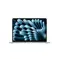 Apple MacBook Air, iBite Nitra